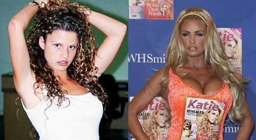 A picture of Katie Price before (left) and after (right).